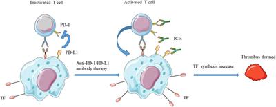 Risk Factors, Incidence, and Prognosis of Thromboembolism in Cancer Patients Treated With Immune Checkpoint Inhibitors